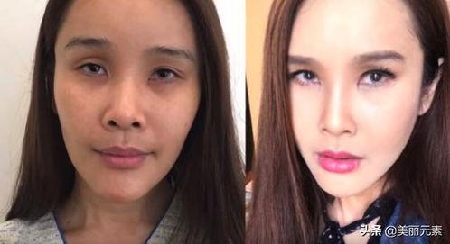 整容视频全过程,从术前准备到术后恢复