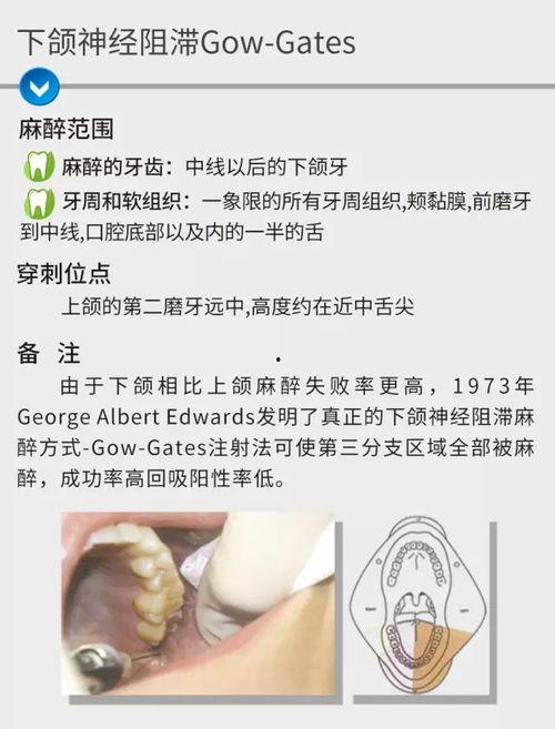 口腔局麻视频,口腔局麻操作步骤及要点解析